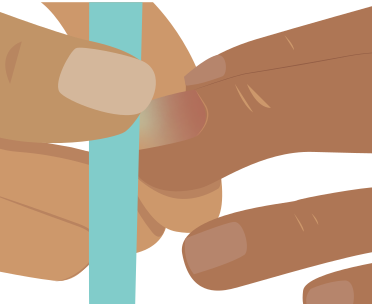 Ilustração em close-up de duas mãos com tons de pele parda. O polegar da mão esquerda pressiona diretamente a unha (leito ungueal) do dedo indicador da outra mão, demonstrando o teste de perfusão. Há uma barra vertical azul-clara ao fundo.