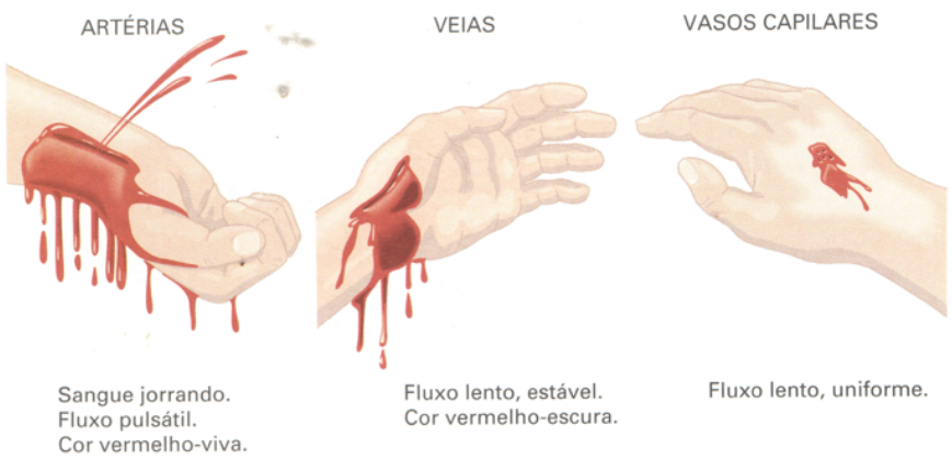Ilustração comparando padrões de sangramento em artérias, veias e vasos capilares. À esquerda, sangramento arterial com jatos pulsáteis e sangue vermelho-vivo; ao centro, sangramento venoso com fluxo lento e estável de sangue vermelho-escuro; à direita, sangramento capilar com fluxo lento e uniforme.