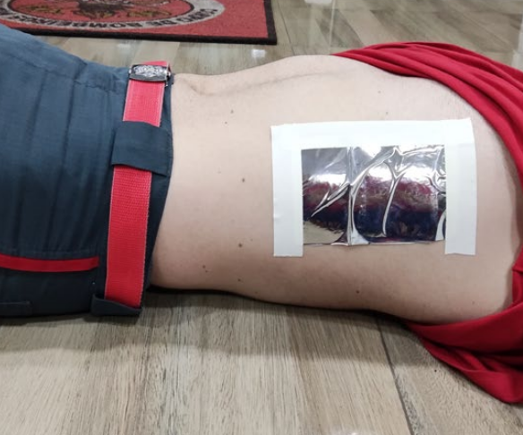 Paciente em decúbito lateral sobre piso de madeira, apresentando na região lateral do tórax um curativo oclusivo improvisado com material plástico fixado por fita adesiva em três lados, utilizado como medida de emergência para tratamento de pneumotórax aberto.