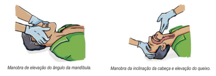 Ilustração de duas manobras de abertura das vias aéreas em pessoa deitada: à esquerda, elevação do ângulo da mandíbula; à direita, inclinação da cabeça com elevação do queixo.