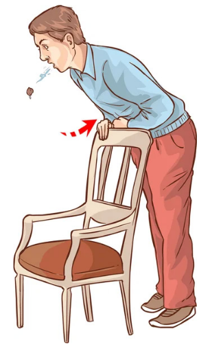 Ilustração de uma pessoa com obstrução total das vias aéreas inclinando o abdome contra o encosto de uma cadeira para realizar compressões abdominais autoadministradas e desobstruir a via aérea.