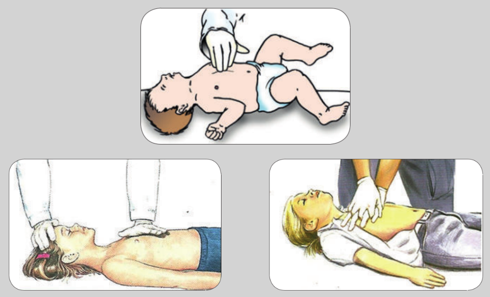 Ilustrações demonstrando a técnica de compressões torácicas na ressuscitação cardiopulmonar (RCP) em diferentes faixas etárias. Na parte superior, compressões realizadas em lactente utilizando dois dedos sobre o esterno. Na parte inferior, compressões em crianças utilizando uma das mãos ou as duas mãos sobrepostas no centro do tórax.