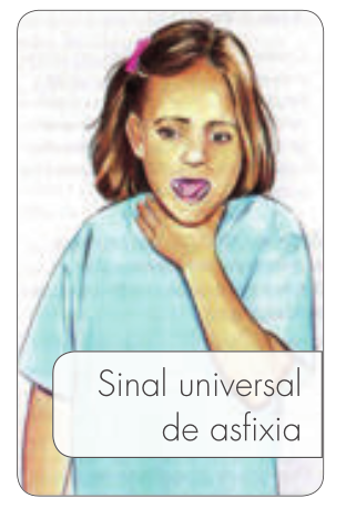 Ilustração de uma criança realizando o sinal universal de asfixia, com uma das mãos ao redor do pescoço e a boca aberta, indicando obstrução das vias aéreas por corpo estranho.
